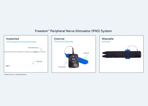 A labelled diagram of the Freedom Peripheral Nerve Stimulator (PNS) System.