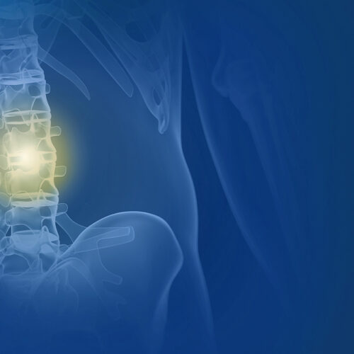 Radiofrequency Therapy