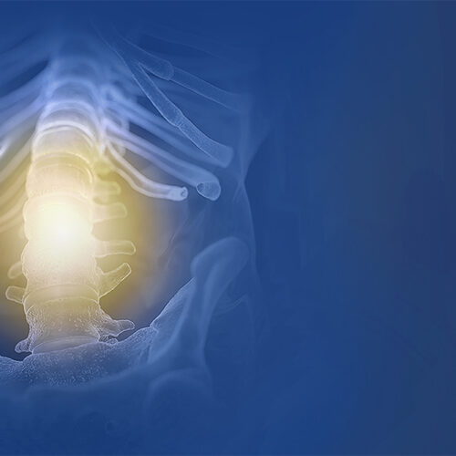 Epidural Adhesiolysis Therapy